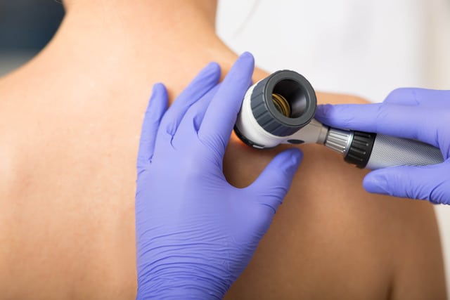 Dermatologist examining a patient's back using a magnifying tool during an annual skin exam.