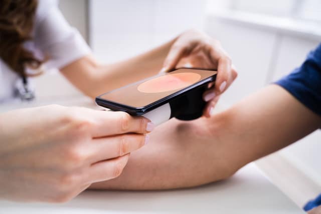 Patient having their arm examined during a skin cancer evaluation.